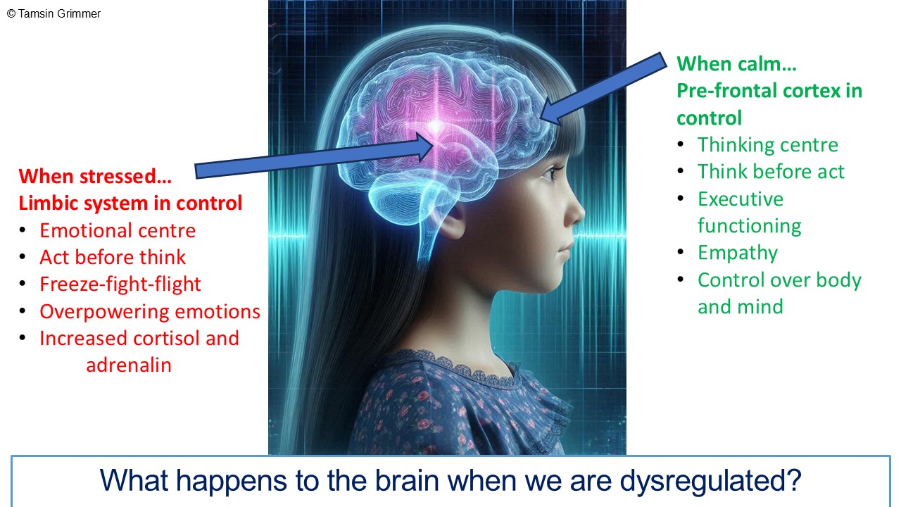 Freeze fight flight in the brain